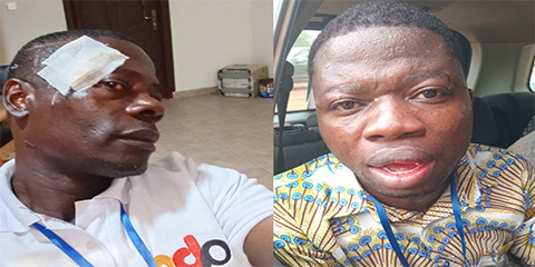 At least 5 Ghanaian journalists attacked covering Ashanti elections 