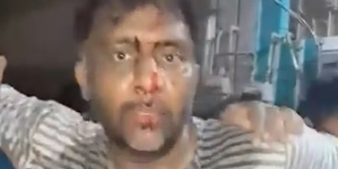 Masked assailants brutally attack journalist Noor-ul-Arfeen at home in Malir